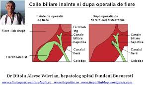 Caile biliare operate