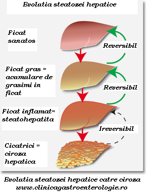 Steatoza hepatica