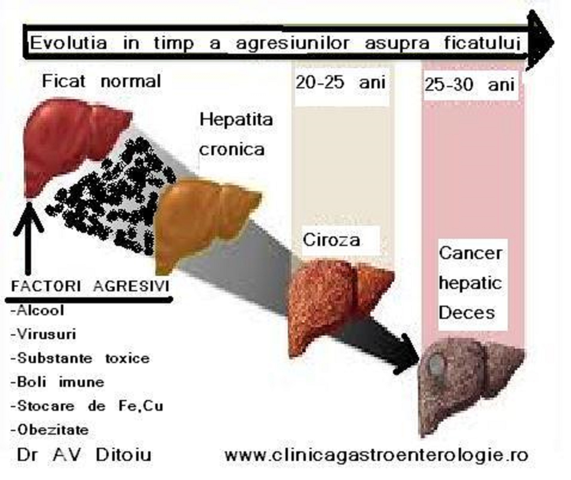 Hepatita C cu evolutie galopanta